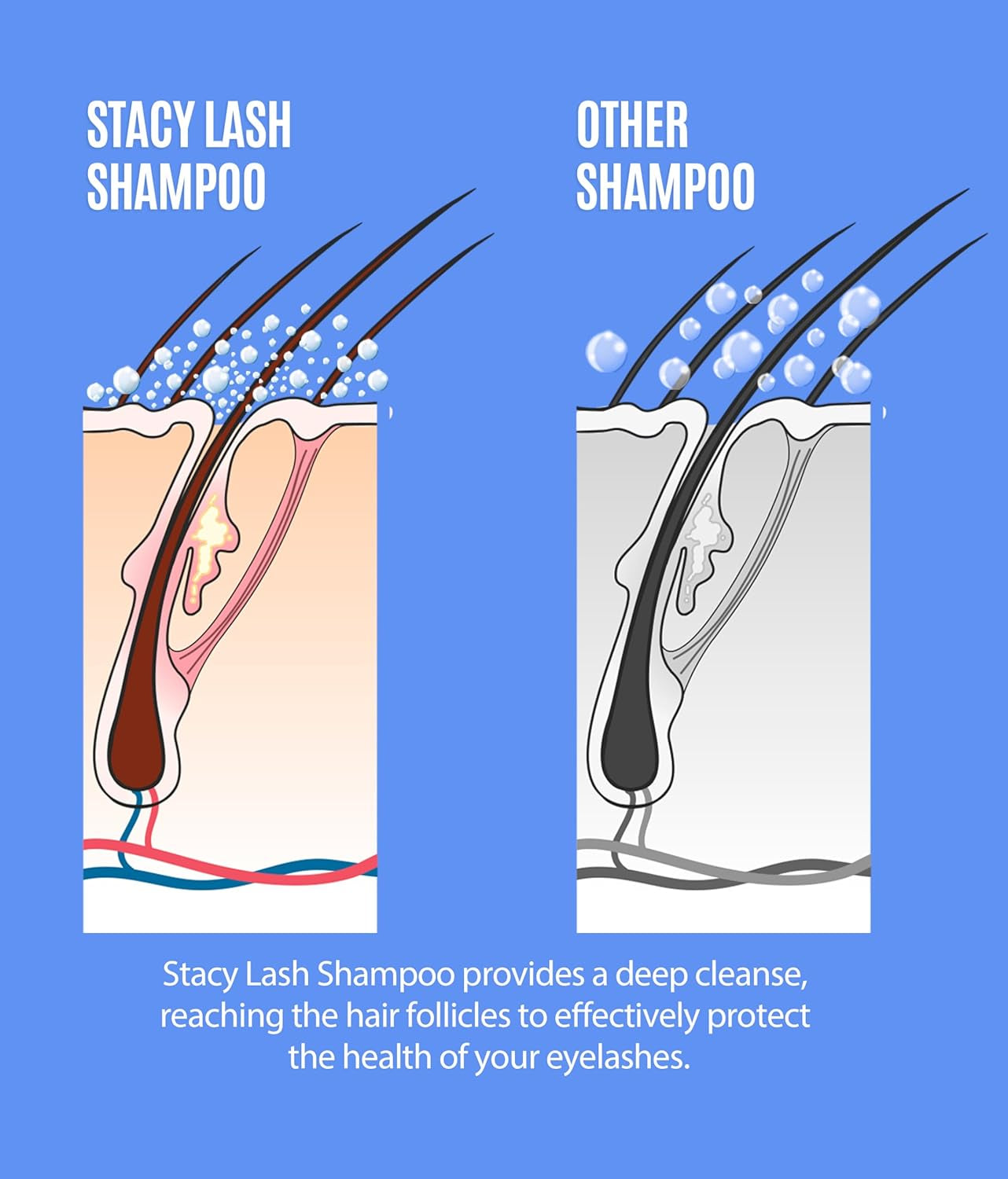 Lash Shampoo 100Ml+ Eyelash Growth Serum Cleaning Kit of Eye Makeup Remover (Cleanser) + Brush & Eyelash Serum for Eyelash Growth and Thickness